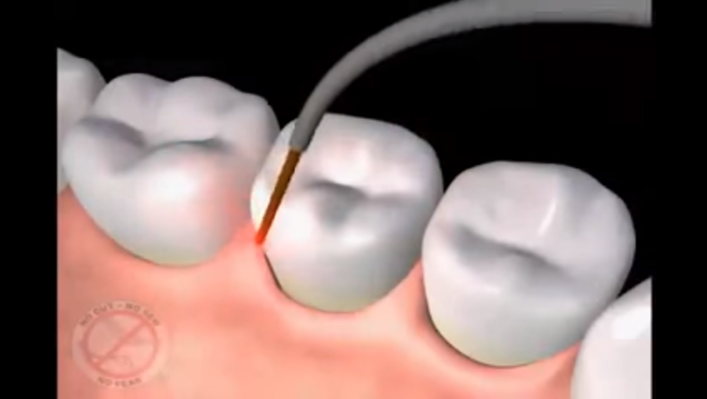 gum disease treatment westerly ri